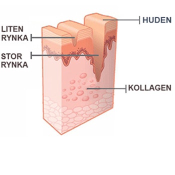 Så fungerar kollagen för att minska mörka ringar under ögonen.