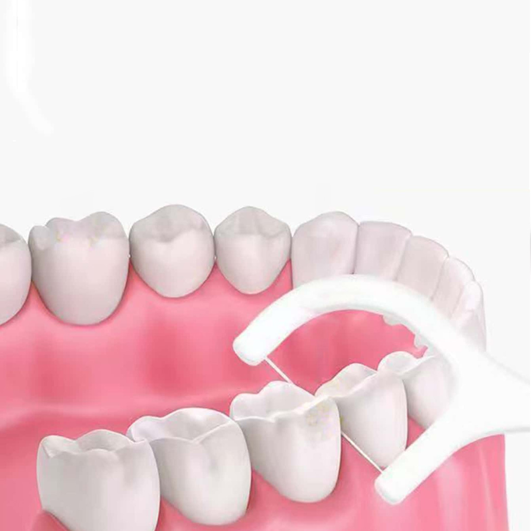 Tandtrådsbygel (50st)