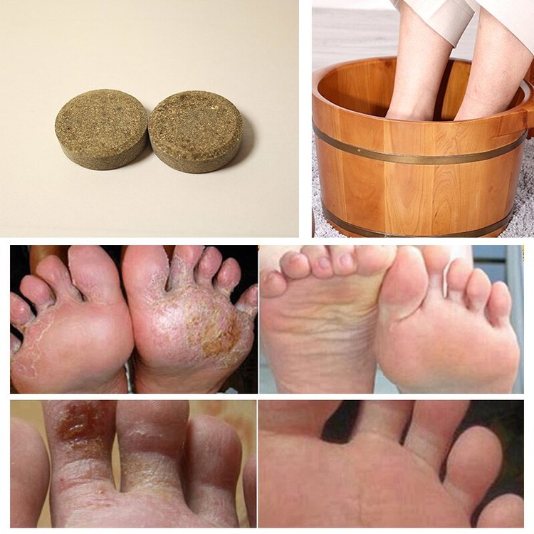 Anti Svamp Detox Foot