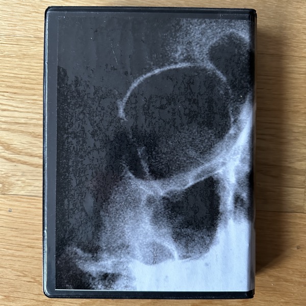 CONCRETE THREAT Harsh Noise Death (Blood edition) (HarshFuckedForLife - Sweden original) (NM/VG+) 6xTAPE BOX
