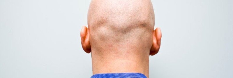 5 saker att tänka på när du rakar huvudet första gången