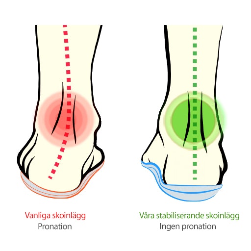 Skosula pronation