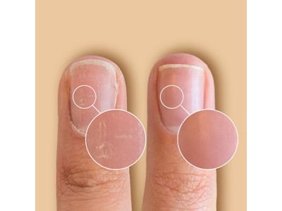 SolarOil Nail & Cuticle Treatment Nagel & nagelbandsolja