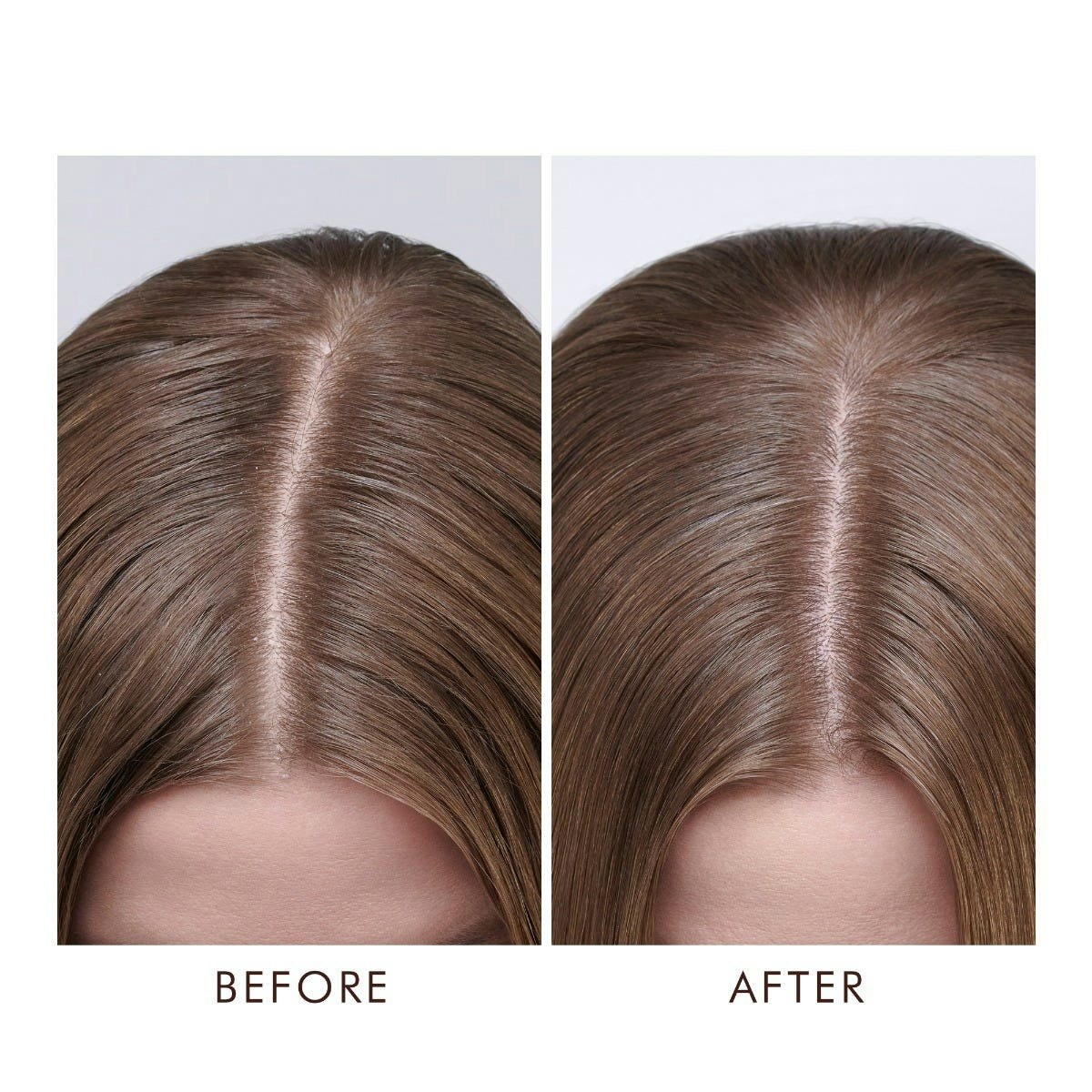 Moroccanoil - Dry Scalp Treatment (Torr hårbotten)