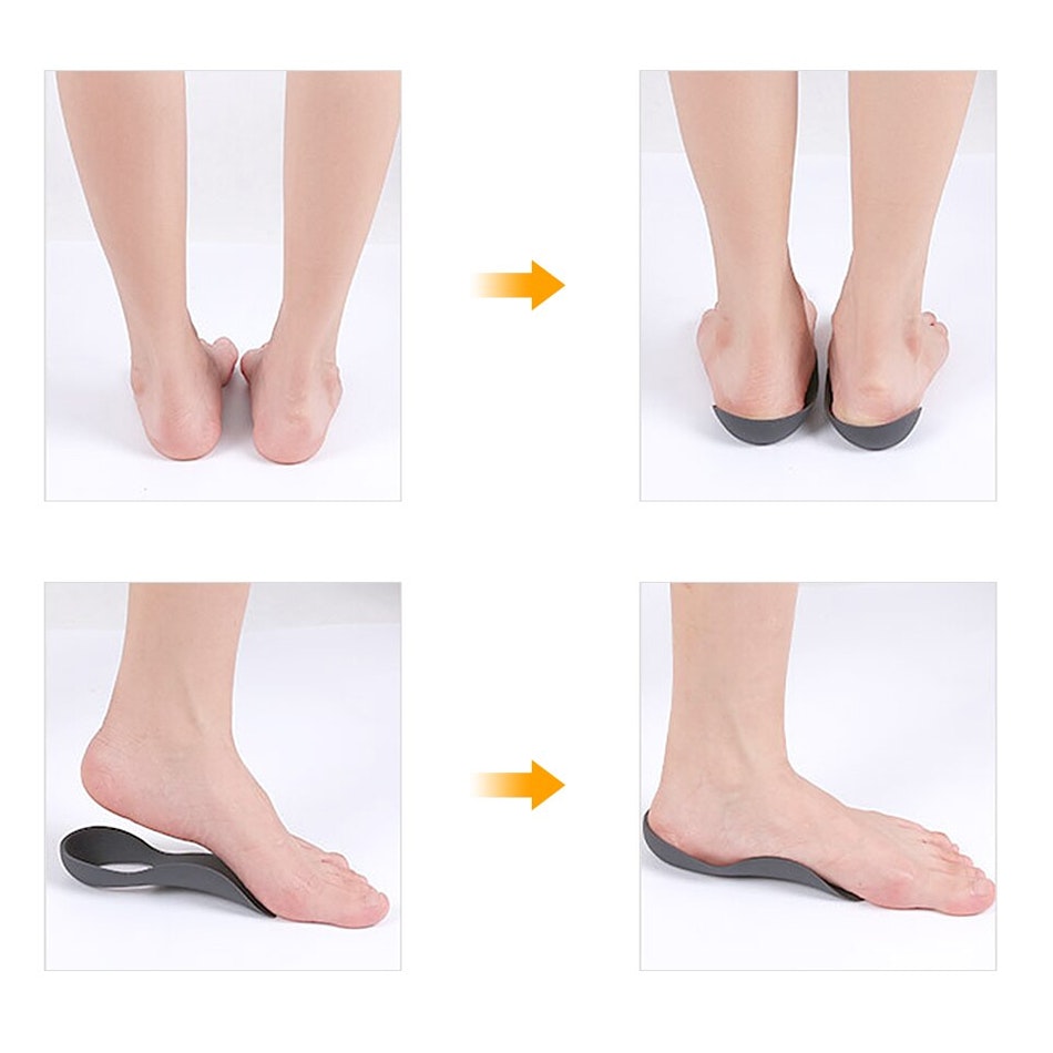 Tilslutte Generalife hvor som helst Svangstøtte til børn - Giver en korrekt nedsætning af foden (239 kr) -  Fodplejebutikken