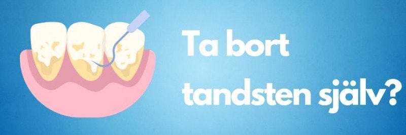 Ta bort tandsten själv