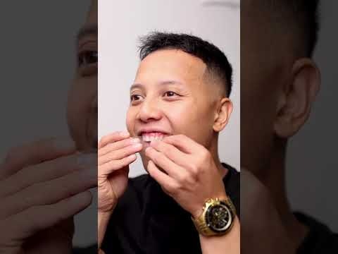 WeSmile Whitening strips