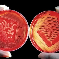Helicobacter Pylori (Mag-tarm bakterie) - (Norvia 17)