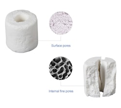 Keramiska ringar 12 mm - 500g