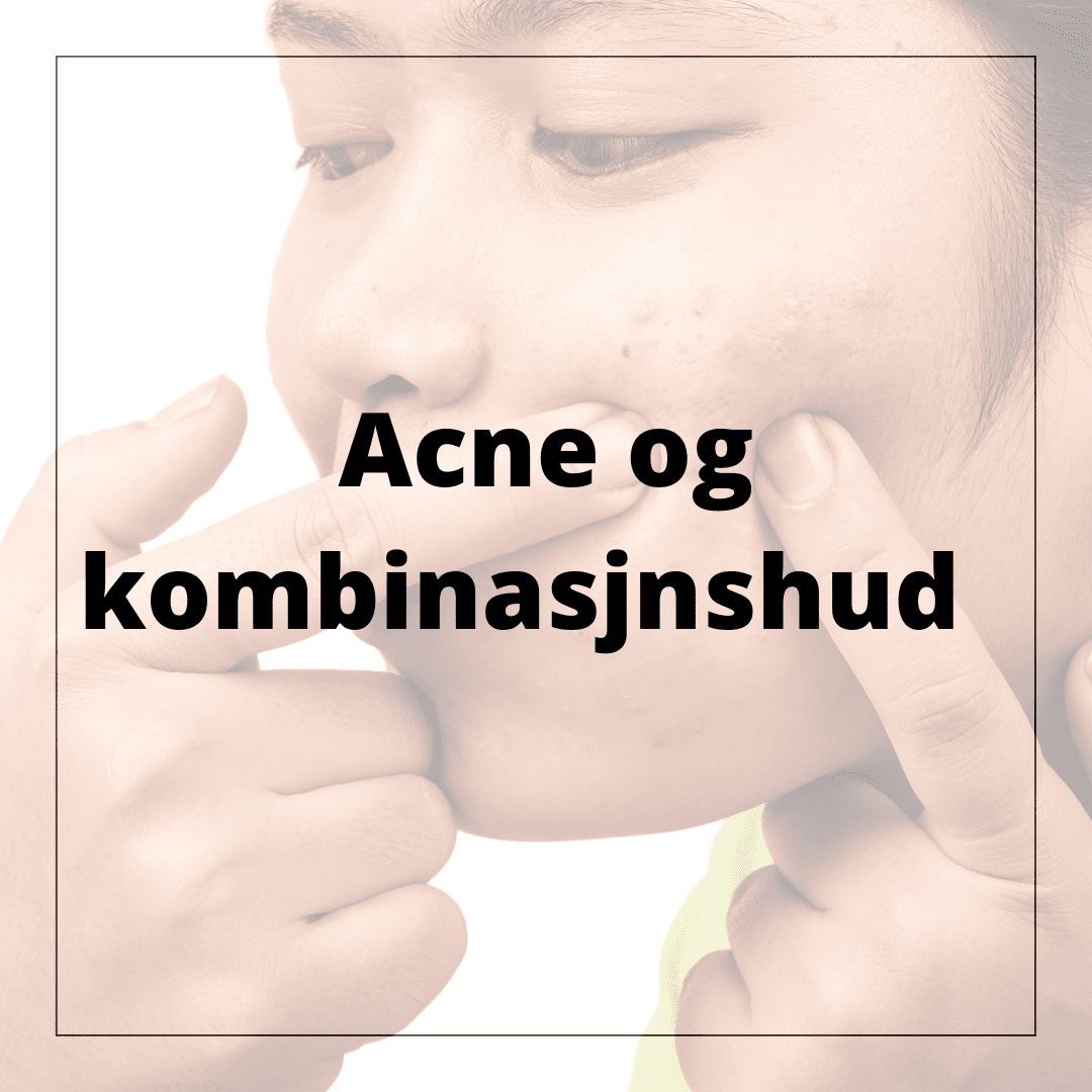 Acne / kombinasjons hud - hudshop.no 