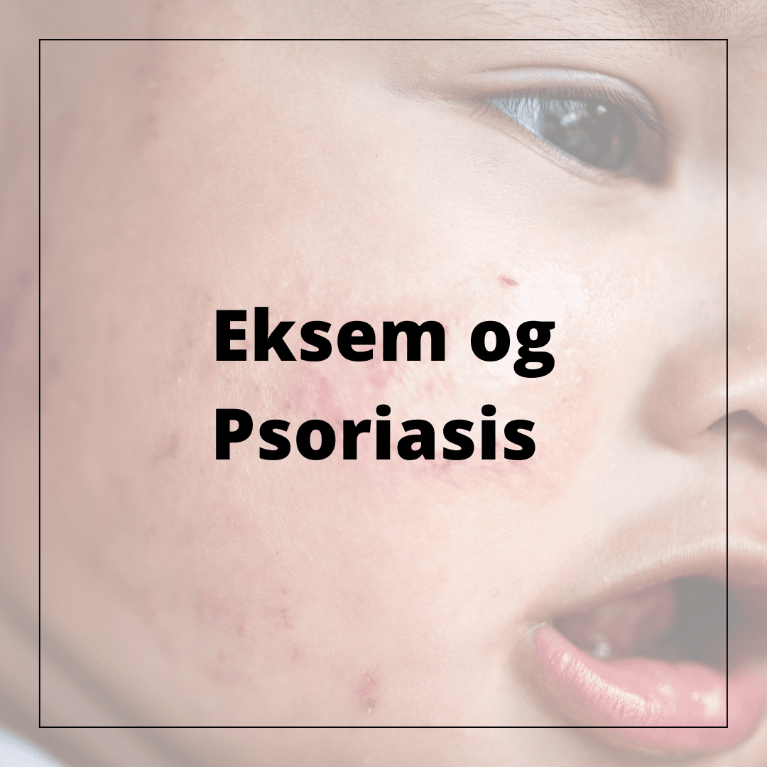 Eksem og Psoriasis - hudshop.no 