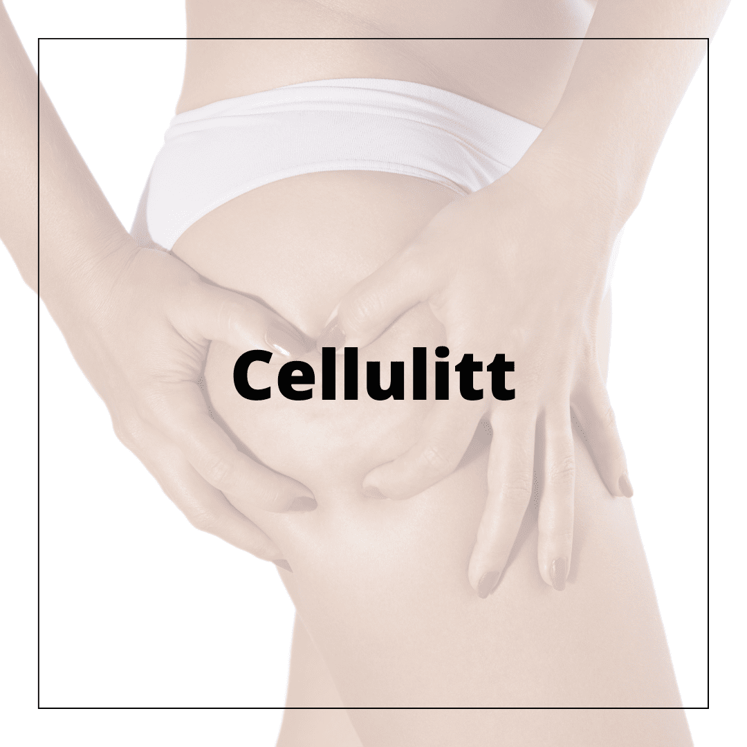 Cellulitt - hudshop.no