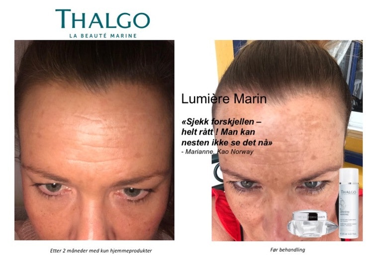 THALGO  Lumière Marine  Targeted Dark Spot Corrector, 15 ml. - serum til lokalt bruk