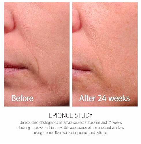 Epionce - Renewal Facial Lotion 50 ml