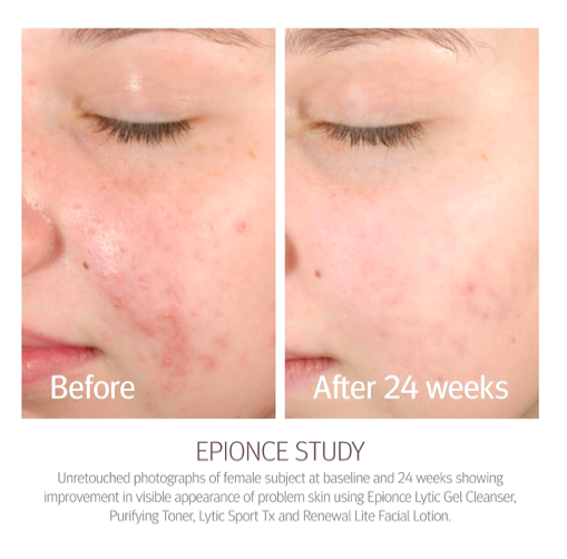 Epionce - Purifying Toner 120ml