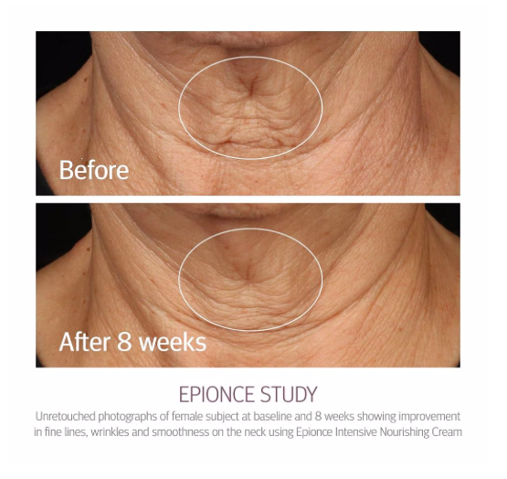 Epionce - Intensive Nourishing Cream 50g