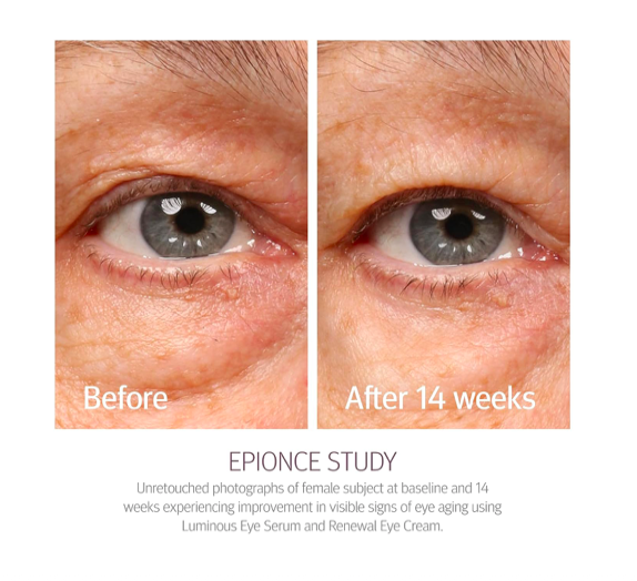 Epionce - Renewal Eye Cream 15g