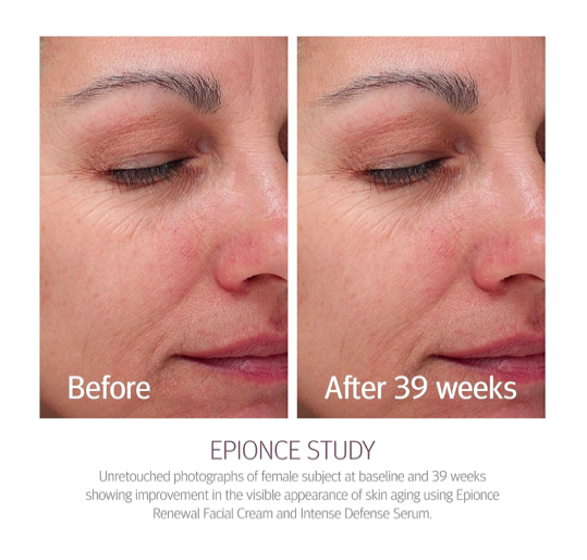 Epionce Renewal Facial Cream 50g