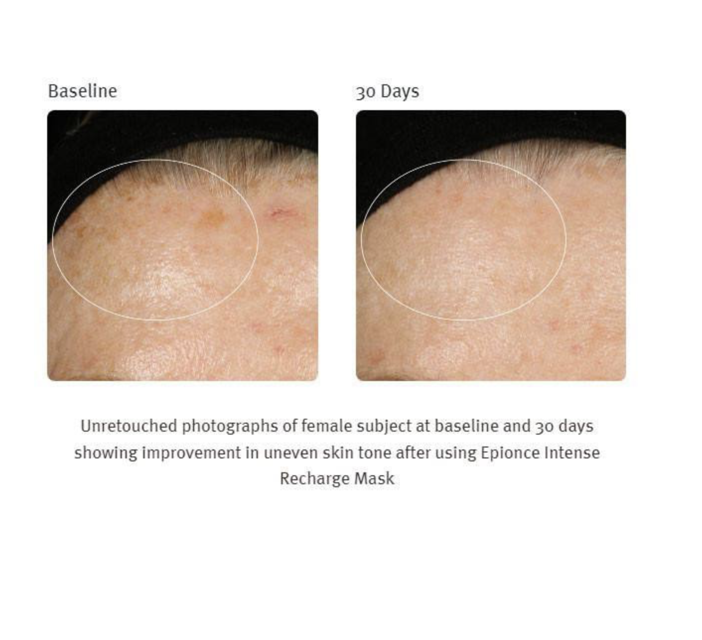 Epionce - Intense Recharge Mask