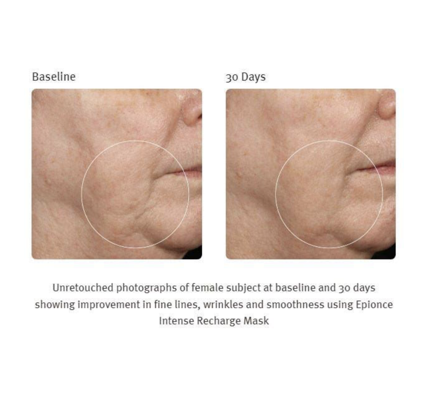 Epionce - Intense Recharge Mask