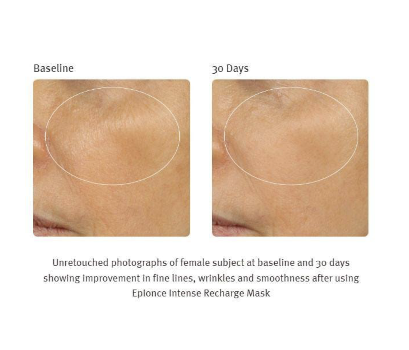 Epionce - Intense Recharge Mask