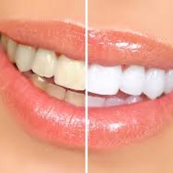 AP 24 Whitening tandkräm