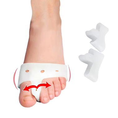 Hallux valgus (2st)