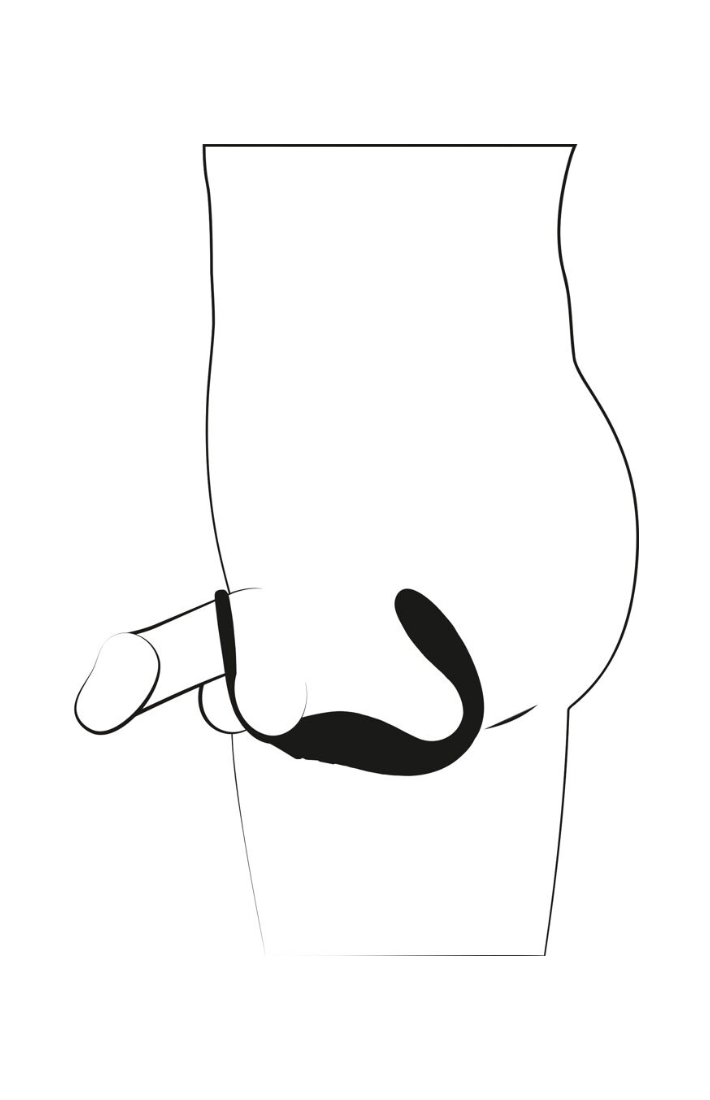 RC Ring & Plug