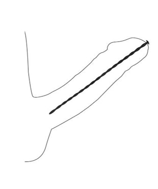 Spiral Dilator Set