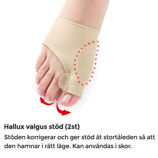 Hallux valgus-pakket