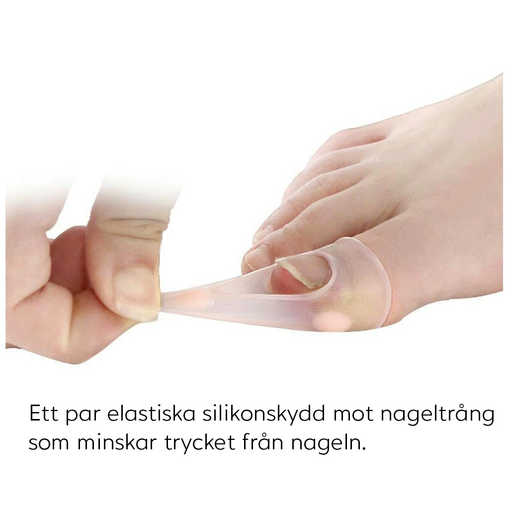 Inåtväxande nagel (Silikonskydd)