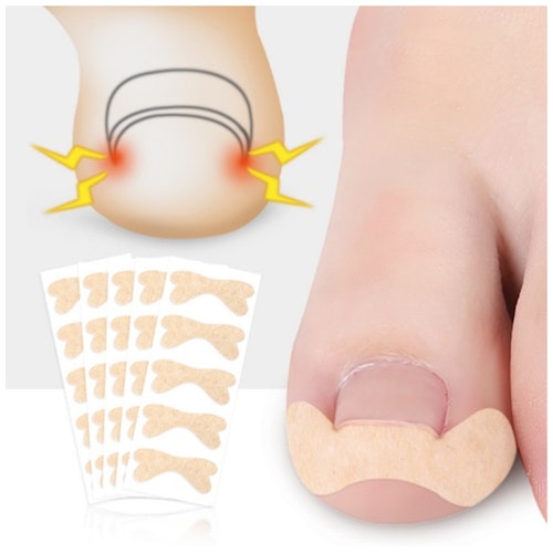 Nageltrång (Tejp)