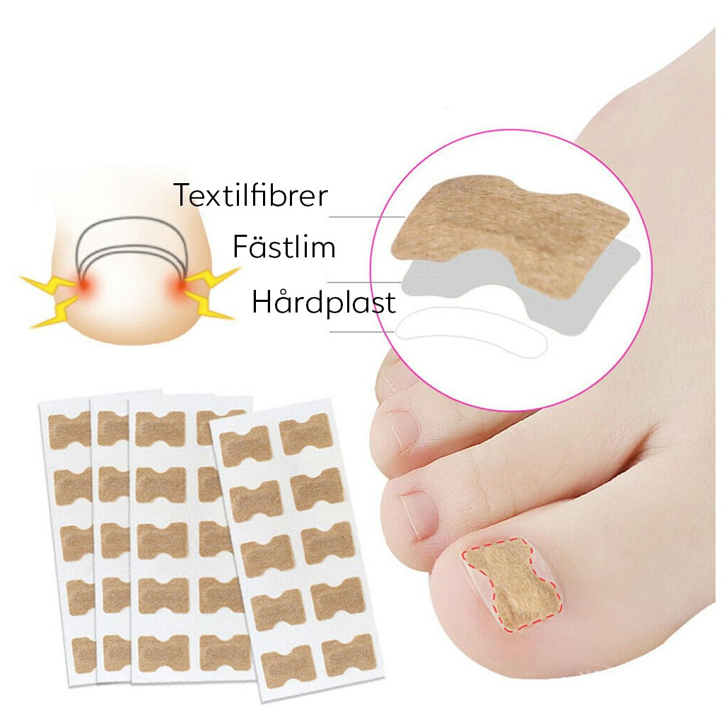 Plåster mot nageltrång (10st)
