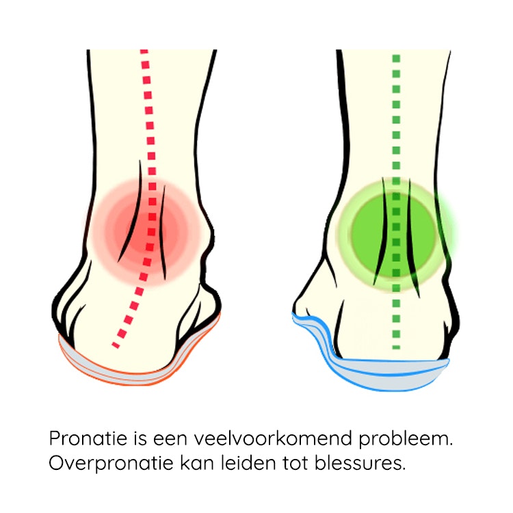 Inlegzolen pronatiesteun