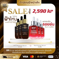 Melasma 3 Red 3