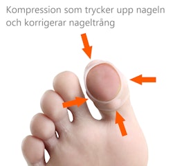 Nageltrång korrigerande silikonskydd för stortå 2st