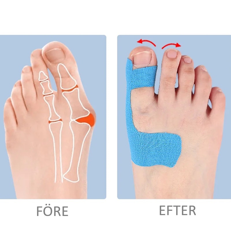 Kinesiotejp hallux valgus 10st , färdigskuren BEIGE