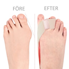 Hallux Valgus korrigerande band med tåseparerare BEIGE