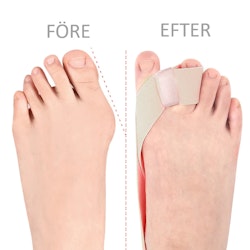 Hallux Valgus korrigerande band med tåseparerare BEIGE