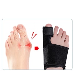 Hallux valgus korrigerande stödskena med justerbart band 1st