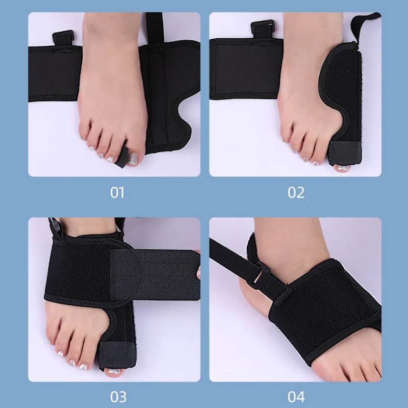 Hallux valgus korrigerande stödskena med justerbart band 1st