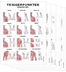 Triggerpunkter 50x70 cm Anatomiplansch - Friskia