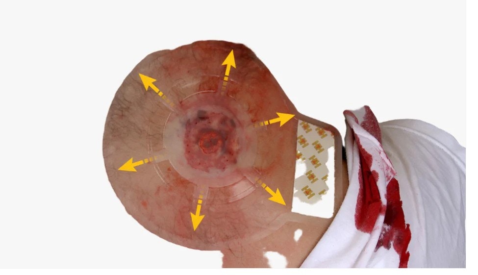 Hyvent vented chest seal, twin pack