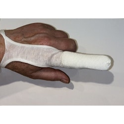 FingerDerm