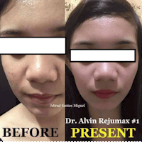 Dr. Alvin Rejuvmax set 1 Professional Skin Care
