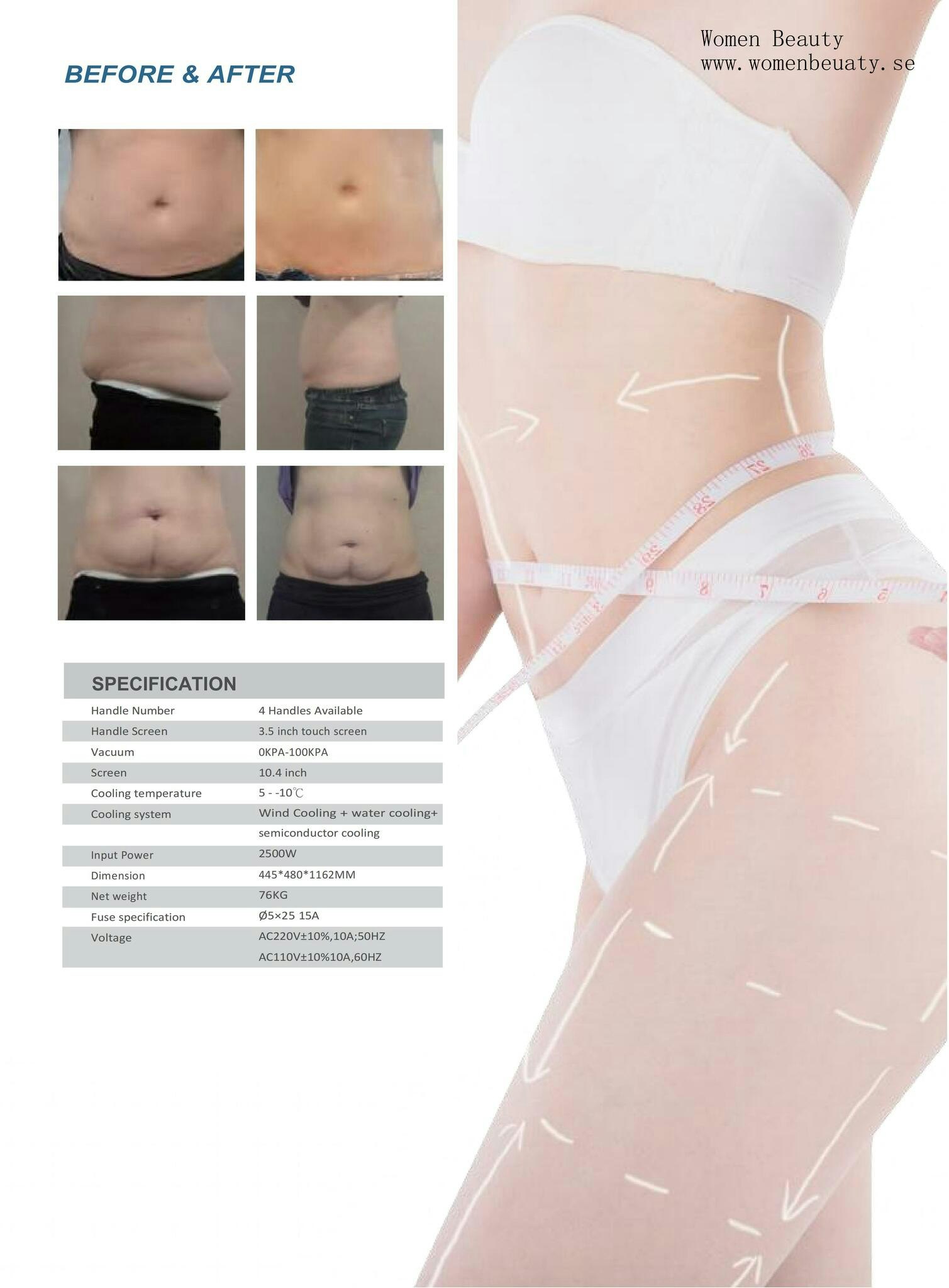 Cryolipolysis Slimming machine / fråga om offert
