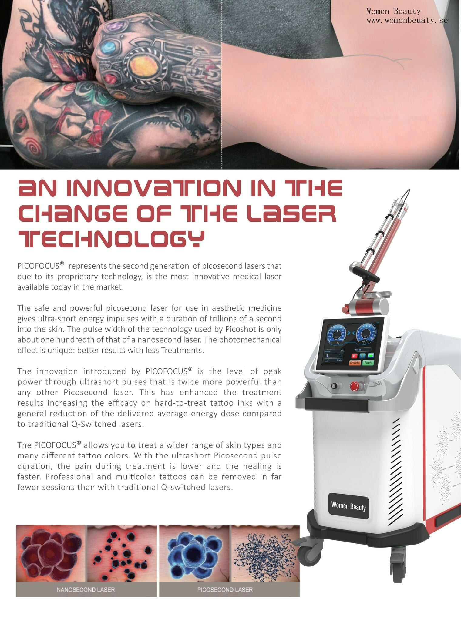 laser and nd yag laser/ fråga om offert