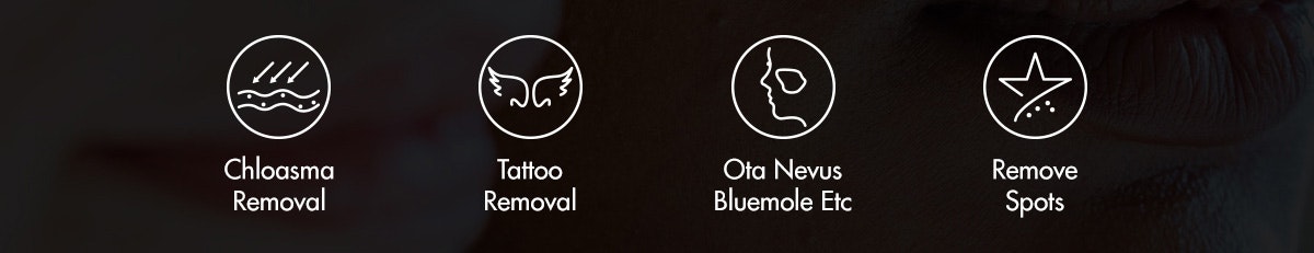 pikose kundlasermaskiner för tatuerings borttagning