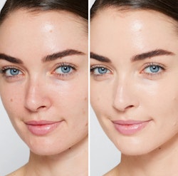 Skintuition SPF 30 - Light 26