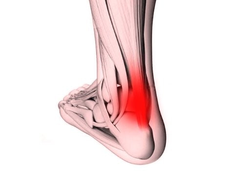 Hälseneinflammation - Rehab Prylar